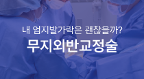 무지외반교정술