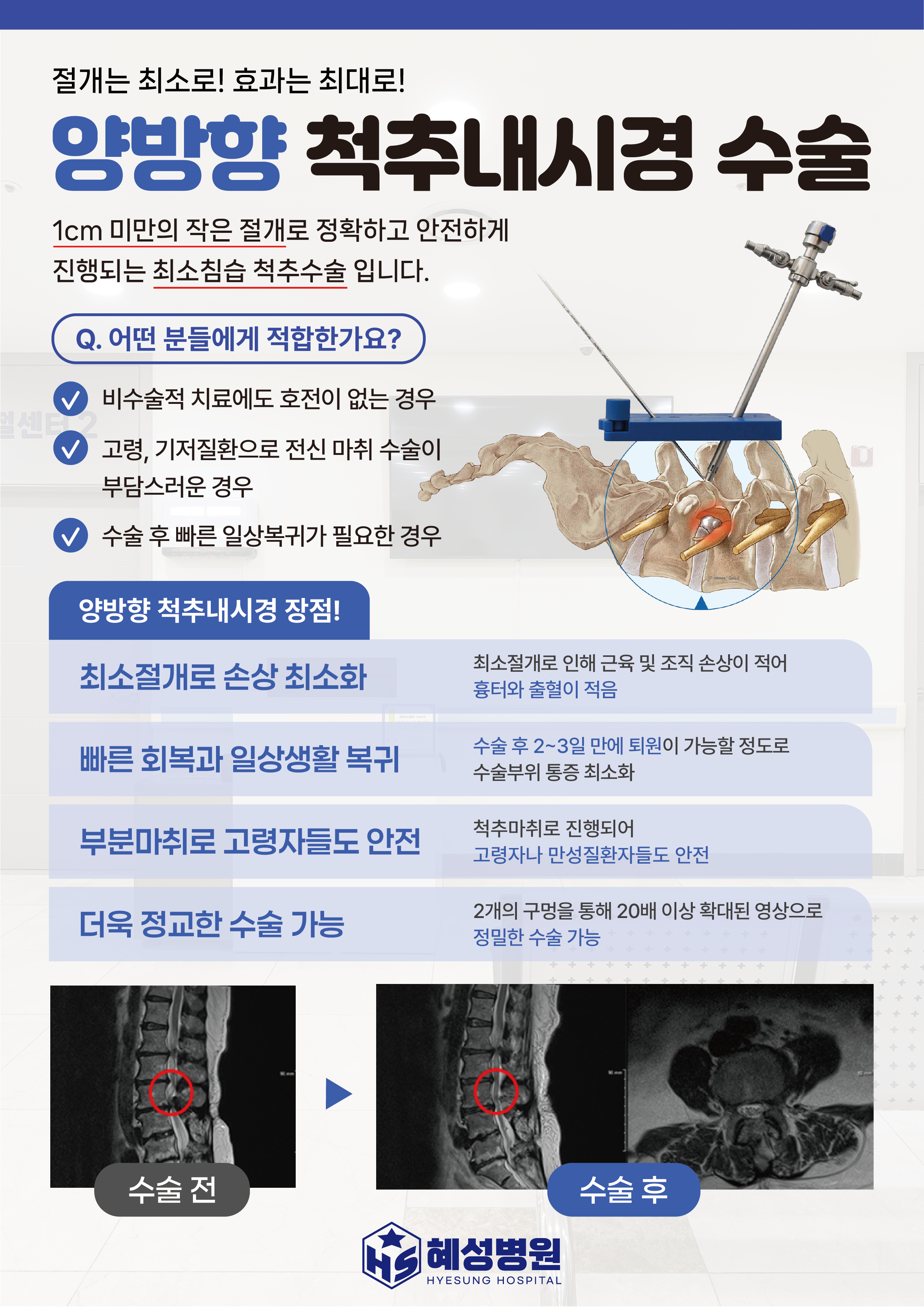 팝업 이미지