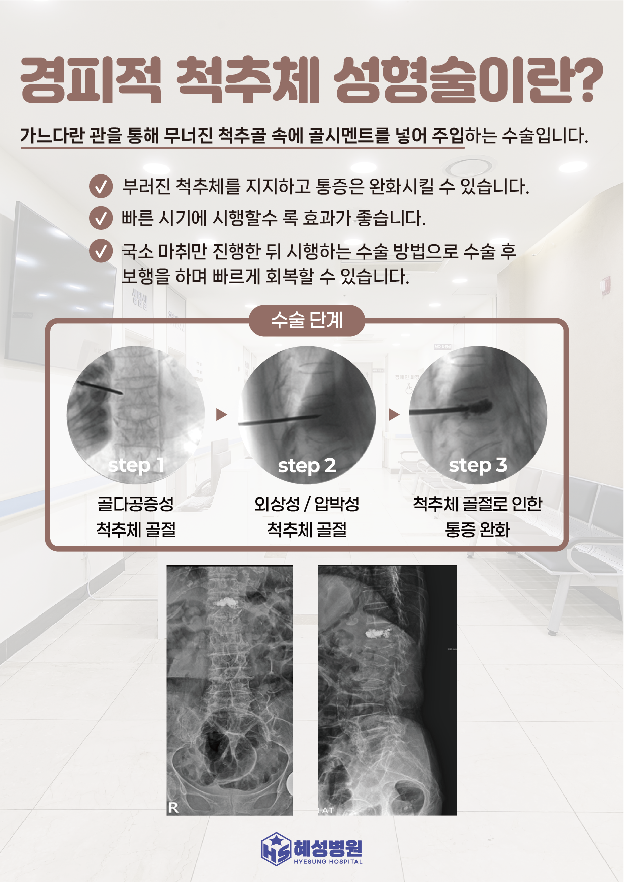 팝업 이미지